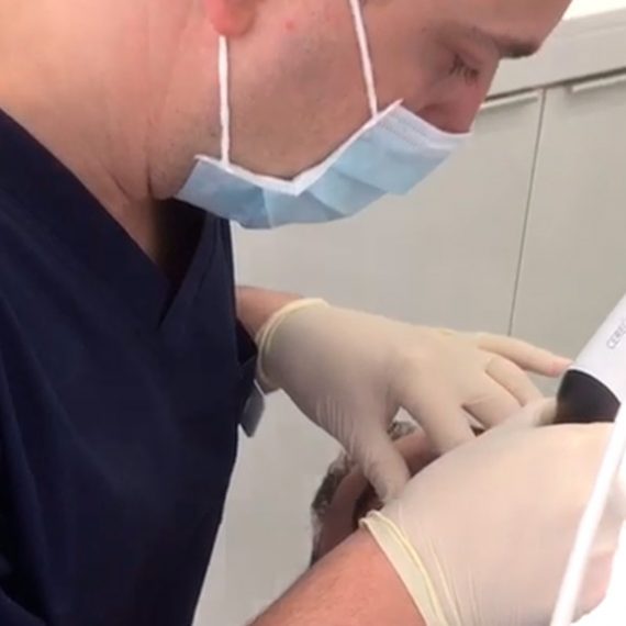 escaner-fresadora-burgos