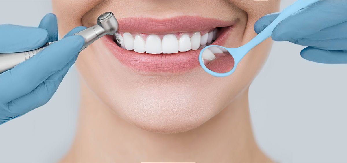 manchas-dientes